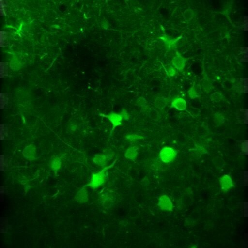 Excitatory neurons in a sleeping mouse - Credits: Dr. M. Aime, Adamantidis Lab 2022. Acquired using the Scientifica HyperScope