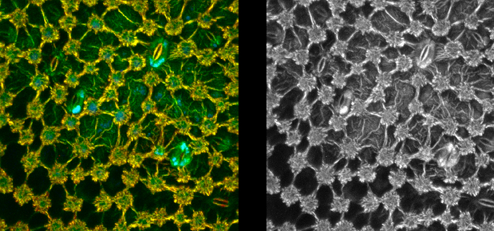 Images taken from the same autofluorescent plant leaf sample. Left: taken using FLIM. Right: taken using maximum intensity projection (MIP) imaging, The FLIM image shows areas that have the same brightness but very different lifetimes, which are not shown in the MIP image. Images taken from the same autofluorescent plant leaf sample. Left: taken using FLIM. Right: taken using maximum intensity projection (MIP) imaging, The FLIM image shows areas that have the same brightness but very different lifetimes, which are not shown in the MIP image.