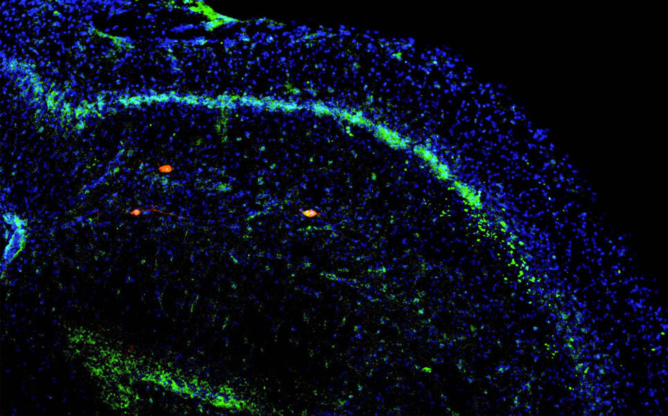 Finding your car in a parking lot relies on this newly discovered brain circuit. Image credit: Ruchi Malik / UCSF