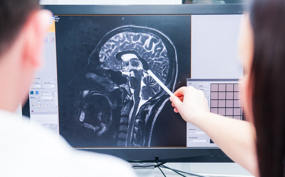 A replay of life: What happens in our brain when we die? Image credit: Frontiers/Okrasiuk/Shutterstock.com A replay of life: What happens in our brain when we die? Image credit: Frontiers/Okrasiuk/Shutterstock.com